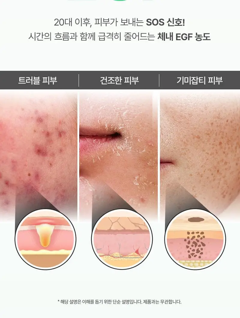 [수분진정/시원탱글] 지피덤 셀트리온EGF 스킨베리어 하이드레이팅 수분크림 80ml 상세페이지 9